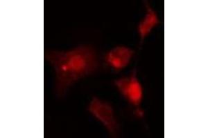 ABIN6275897 staining  Hela cells by IF/ICC. (INA 抗体  (Internal Region))