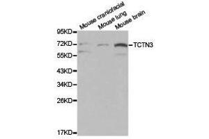 Western Blotting (WB) image for anti-Tectonic Family Member 3 (TCTN3) antibody (ABIN1875046) (TCTN3 抗体)