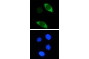 Cas9 antibody (mAb) tested by Immunoflourescence. (CRISPR-Cas9 (N-Term) 抗体)