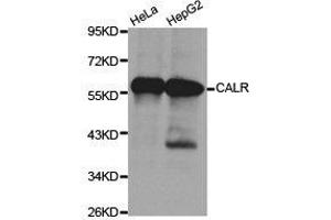 Western Blotting (WB) image for anti-Calreticulin (CALR) antibody (ABIN1871404) (Calreticulin 抗体)