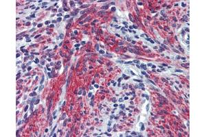 Immunohistochemistry (IHC) image for anti-Periostin (POSTN) (N-Term) antibody (ABIN2776882) (Periostin 抗体  (N-Term))
