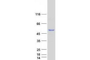 Western Blotting (WB) image for Interferon-Induced Protein 44 (IFI44) protein (Myc-DYKDDDDK Tag) (ABIN2723298)