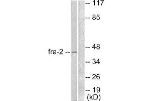 Western Blotting (WB) image for anti-FOS-Like Antigen 2 (FOSL2) (C-Term) antibody (ABIN1848552) (FOSL2 抗体  (C-Term))
