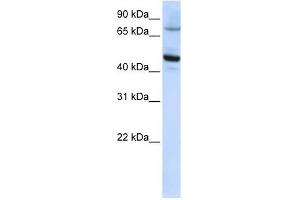 CYP46A1 antibody used at 1 ug/ml to detect target protein. (CYP46A1 抗体  (C-Term))