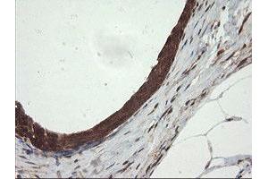 Image no. 1 for anti-Ubiquitin-Conjugating Enzyme E2G 2 (UBE2G2) antibody (ABIN1501634) (UBE2G2 抗体)