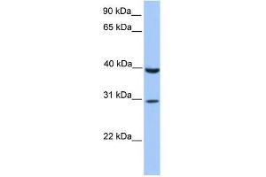 JAZF1 antibody used at 1. (JAZF1 抗体  (C-Term))