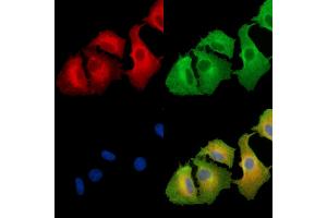 ABIN6263527 and ABIN6279597 staining  cells by IF/ICC. (NBPF6 抗体  (C-Term))