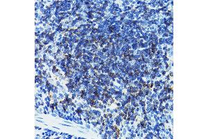Immunohistochemistry of paraffin-embedded mouse spleen using CD79B Rabbit pAb (ABIN3022745, ABIN3022746, ABIN3022747 and ABIN6219206) at dilution of 1:100 (40x lens).