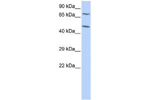 WB Suggested Anti-ZNF672 Antibody Titration:  0. (ZNF672 抗体  (Middle Region))