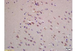 Formalin-fixed and paraffin embedded rat brain labeled with Rabbit Anti BACE1/ASP2 Polyclonal Antibody, Unconjugated (ABIN725705) at 1:200 followed by conjugation to the secondary antibody and DAB staining (BACE1 抗体  (AA 401-501))