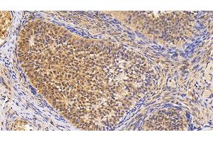 Detection of Surv in Human Ovary Tissue using Monoclonal Antibody to Survivin (Surv) (Survivin 抗体  (AA 1-142))