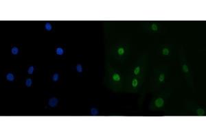 IF analysis of TRBP/TARBP2 using anti-TRBP/TARBP2 antibody (ABIN7600548).