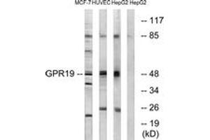 Western blot analysis of extracts from MCF-7/HuvEc/HepG2 cells, using GPR19 Antibody. (GPR19 抗体  (AA 361-410))