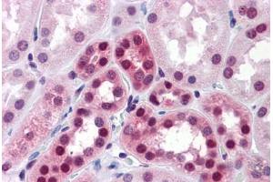 Human Kidney: Formalin-Fixed, Paraffin-Embedded (FFPE) (ELAVL1 抗体  (AA 1-101))