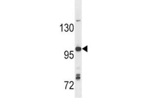 Anti-TLR7 antibody western blot analysis in Ramos lysate (TLR7 抗体  (AA 98-128))