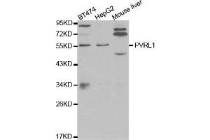 Western blot analysis of extracts of various cell lines, using PVRL1 antibody. (PVRL1 抗体)