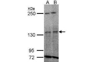 WB Image Sample(30 ug whole cell lysate) A:H1299 B:HeLa S3, 5% SDS PAGE antibody diluted at 1:1000 (TYK2 抗体)