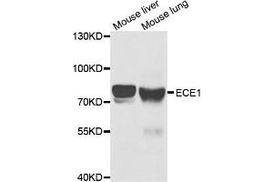 Western Blotting (WB) image for anti-Endothelin-Converting Enzyme 1 (ECE1) antibody (ABIN1876839) (ECE1 抗体)