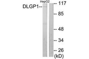 Western Blotting (WB) image for anti-Discs, Large (Drosophila) Homolog-Associated Protein 1 (DLGAP1) (AA 791-840) antibody (ABIN2889307) (DLGAP1 抗体  (AA 791-840))