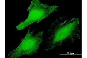 Immunofluorescence of  purified  MaxPab antibody to CLUHP3 on HeLa cell. (CLUHP3 抗体  (AA 1-147))