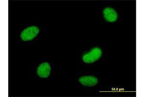 Immunofluorescence of purified MaxPab antibody to SMARCAL1 on HeLa cell. (SMARCAL1 抗体  (AA 1-954))