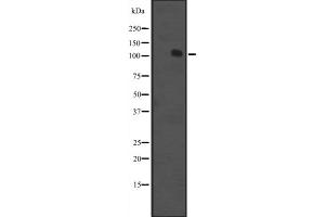 Western blot analysis of MCF2 expression in K562 cell line lysate ;,The lane on the left is treated with the antigen-specific peptide. (MCF2 抗体  (Internal Region))