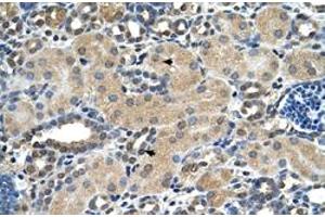 Immunohistochemical staining (Formalin-fixed paraffin-embedded sections) of human kidney with ASPH polyclonal antibody  at 4-8 ug/mL working concentration. (Aspartate beta Hydroxylase 抗体  (N-Term))