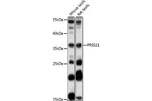 Western blot analysis of extracts of various cell lines, using PRSS21 antibody (ABIN7269581) at 1:1000 dilution. (PRSS21 抗体  (AA 150-220))