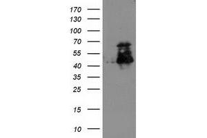 Western Blotting (WB) image for anti-ELK3, ETS-Domain Protein (SRF Accessory Protein 2) (ELK3) antibody (ABIN1498007) (ELK3 抗体)