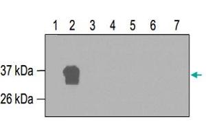 Western blot was performed on seven GST-fusion proteins containing different fragments of RUNX1T1 (Lane 1~7). (RUNX1T1 抗体)