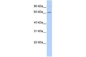 WB Suggested Anti-IKZF4 Antibody Titration:  0. (IKZF4 抗体  (N-Term))
