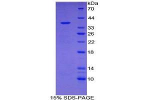 SDS-PAGE analysis of Mouse NADH Dehydrogenase 1 Protein. (MT-ND1 蛋白)