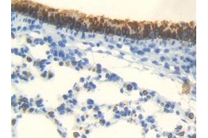 IHC-P analysis of Mouse Lung Tissue, with DAB staining. (Androgen Receptor 抗体  (AA 156-310))