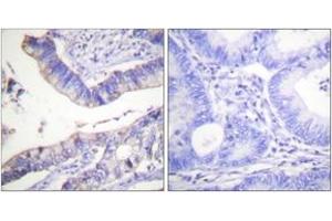 Immunohistochemistry (IHC) image for anti-B-Cell CLL/lymphoma 2 (BCL2) (AA 46-95) antibody (ABIN1532505)