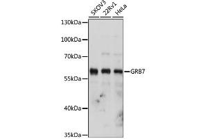 Western blot analysis of extracts of various cell lines, using GRB7 antibody (ABIN1876891) at 1:1000 dilution. (GRB7 抗体)