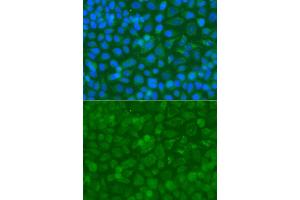 Immunofluorescence analysis of A549 cell using ACAD9 antibody. (ACAD9 抗体)