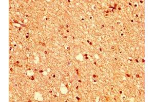 IHC image of ABIN7151835 diluted at 1:400 and staining in paraffin-embedded human brain tissue performed on a Leica BondTM system. (EPH Receptor A2 抗体  (AA 627-976))