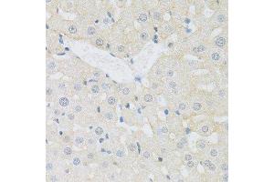 Immunohistochemistry (Paraffin-embedded Sections) (IHC (p)) image for anti-Solute Carrier Family 3 (Activators of Dibasic and Neutral Amino Acid Transport), Member 2 (SLC3A2) (AA 360-529) antibody (ABIN6148000)