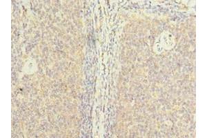 Immunohistochemistry of paraffin-embedded human tonsil tissue using ABIN7176663 at dilution of 1:100 (ZHX1-C8ORF76 Readthrough (ZHX1-C8ORF76) (AA 1-292), (Isoform 2) 抗体)