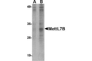 Western Blotting (WB) image for anti-Methyltransferase Like 7B (METTL7B) (N-Term) antibody (ABIN1031456) (METTL7B 抗体  (N-Term))