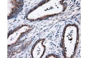 Immunohistochemistry (IHC) image for anti-Induced Myeloid Leukemia Cell Differentiation Protein Mcl-1 (MCL1) antibody (ABIN1499340) (MCL-1 抗体)