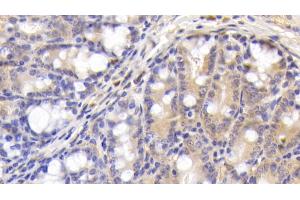 Detection of C4B in Mouse Colon Tissue using Polyclonal Antibody to Complement C4-B (C4B)