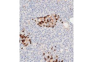 Immunohistochemistry (Paraffin-embedded Sections) (IHC (p)) image for anti-Clusterin (CLU) (AA 71-99), (N-Term) antibody (ABIN654897)
