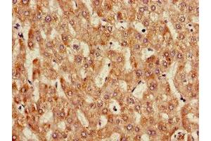 Immunohistochemistry of paraffin-embedded human liver tissue using ABIN7144112 at dilution of 1:100 (ANGPTL3 抗体  (AA 17-268))