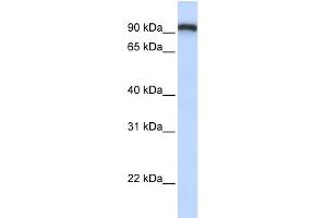 WB Suggested Anti-TMEM168 Antibody Titration:  0. (TMEM168 抗体  (C-Term))