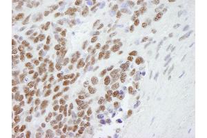 Immunohistochemistry (IHC) image for anti-Chromobox Homolog 3 (CBX3) (C-Term) antibody (ABIN7448460) (CBX3 抗体  (C-Term))