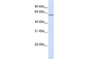 PPP2R3B antibody used at 1 ug/ml to detect target protein. (PPP2R3B 抗体)