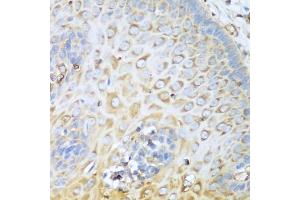 Immunohistochemistry of paraffin-embedded human esophagus using MYH9 antibody. (Myosin 9 抗体)
