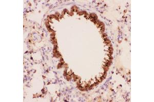 Anti-Annexin A1 Picoband antibody,  IHC(P): Rat Lung Tissue (Annexin a1 抗体  (AA 2-346))