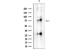 Western blot analysis of lysates from COLO205 cells(heat-shock treatment), using Phospho-IRAK4 (Thr345/Ser346) Antibody at 1/1000 dilution.